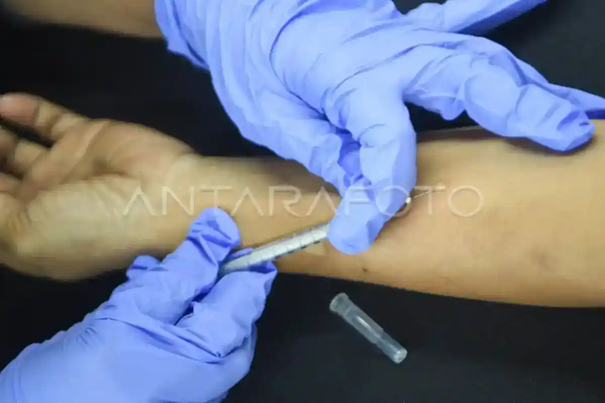 Izin bagi 43 Obat Tuberkulosis Jadi Bagian Upaya Perluas Pilihan Terapi