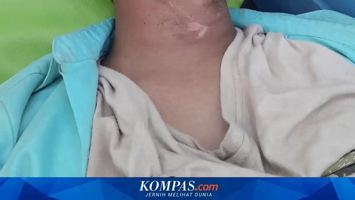 Siswa SMAN 2 Bangkalan Terluka Setelah Leher Terjerat Kabel di Area Proyek